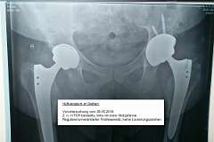 ProShot_20180723_151141